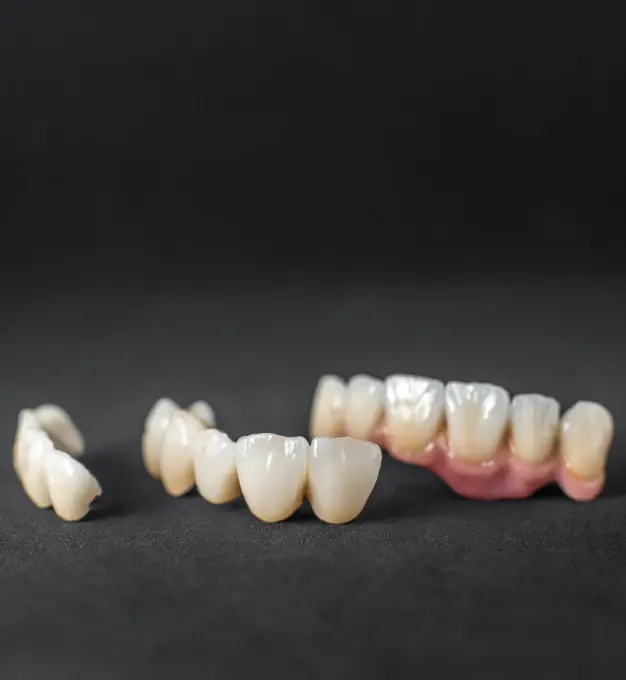 White ceramic dental crowns and tooth-colored prosthetic teeth displayed on dark background.