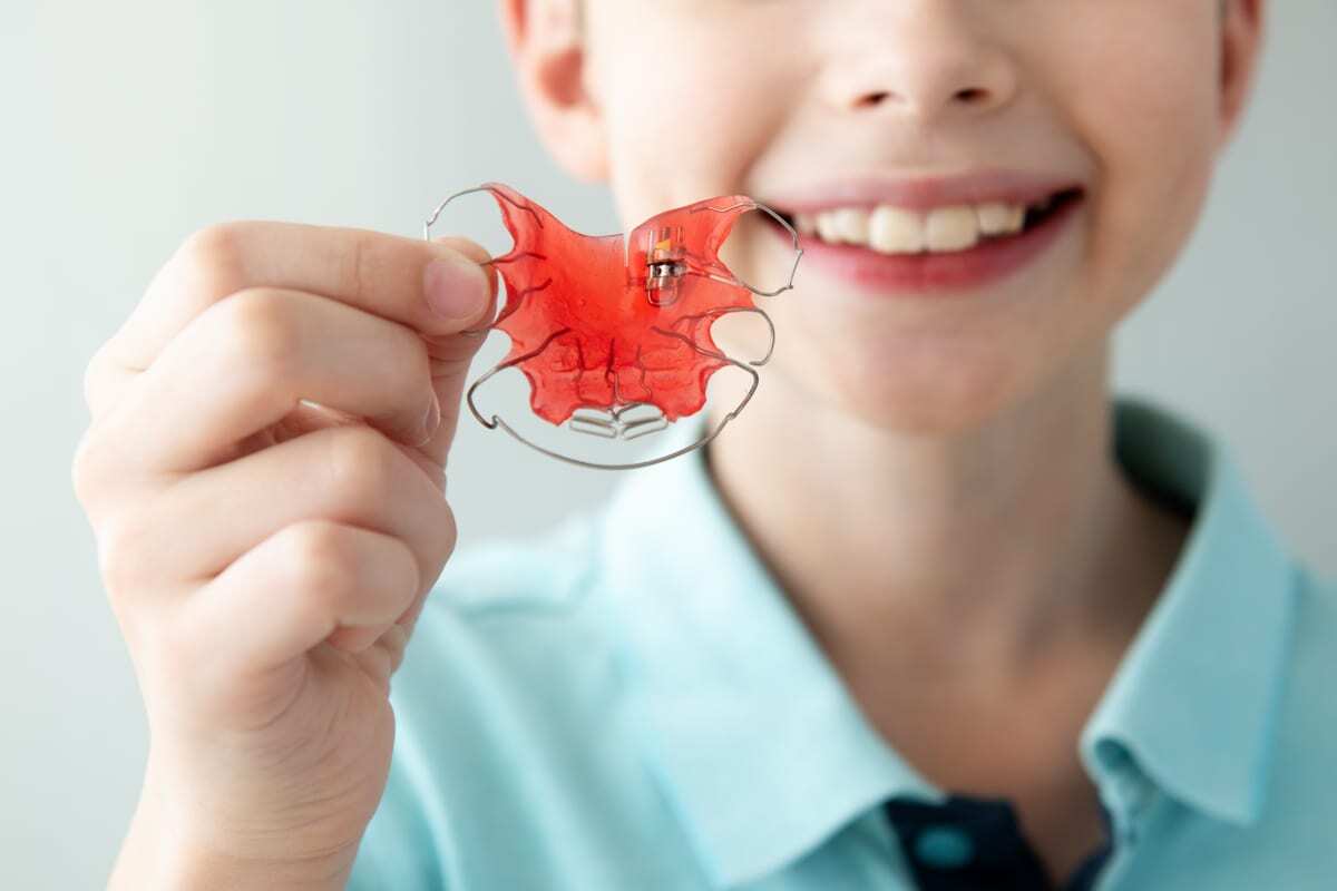 Child holding red orthodontic retainer while smiling, showing dental appliance for bite correction.